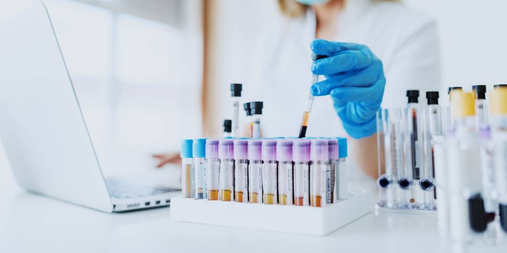 Reagenzgläser in einem Labor von L‘Oréal